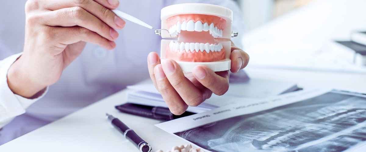 Key Benefits of Dental Cleaning